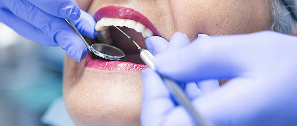 Best Emergency Wisdom Teeth Removal in Warren, MI